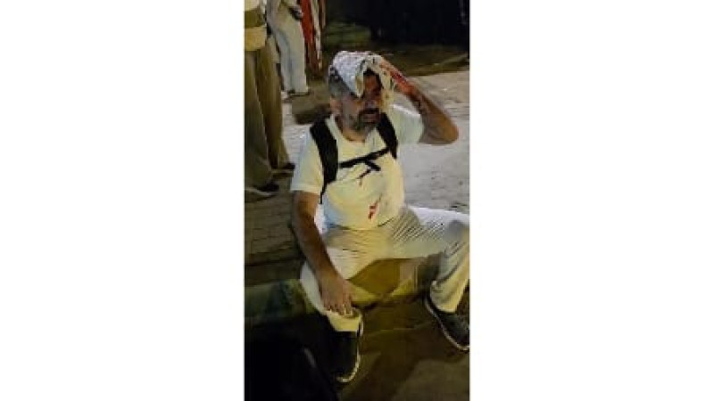 HÜDA PAR Milletvekili Dinç Mısır’da saldırıya uğradı