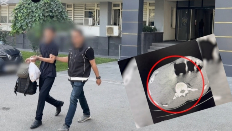EROİNİ MİDESİNDE TAŞIDI